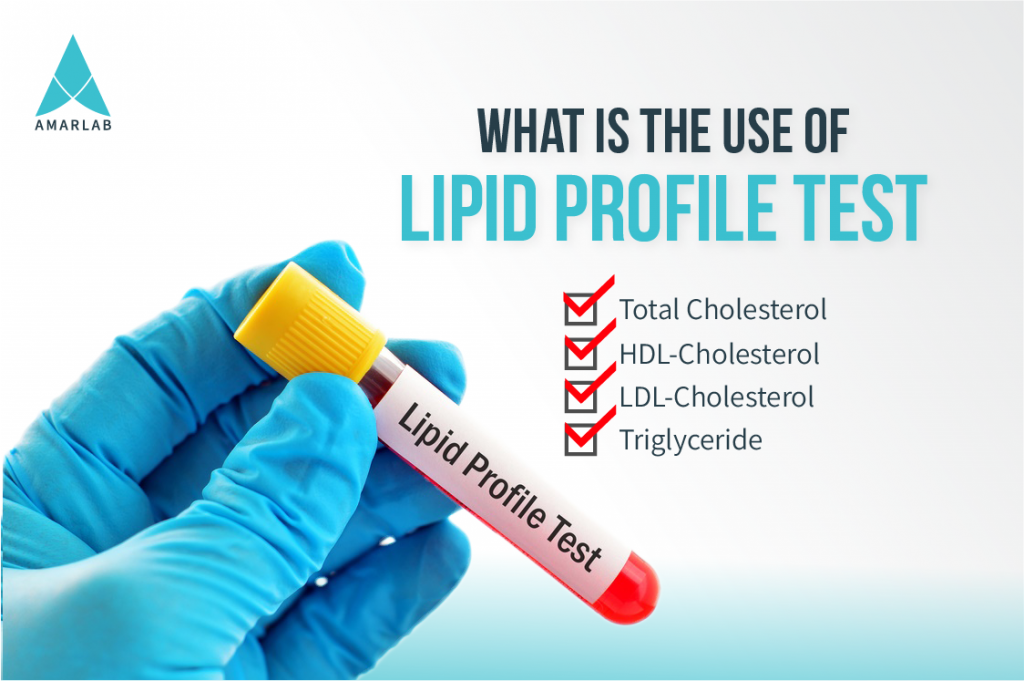 what-is-the-use-of-lipid-profile-test-amarlab-blog