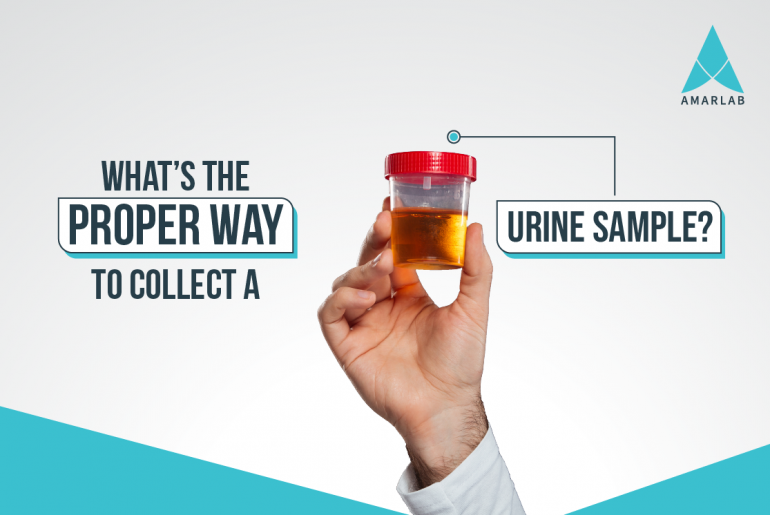 What’s the Proper Way to Collect A Urine Sample?