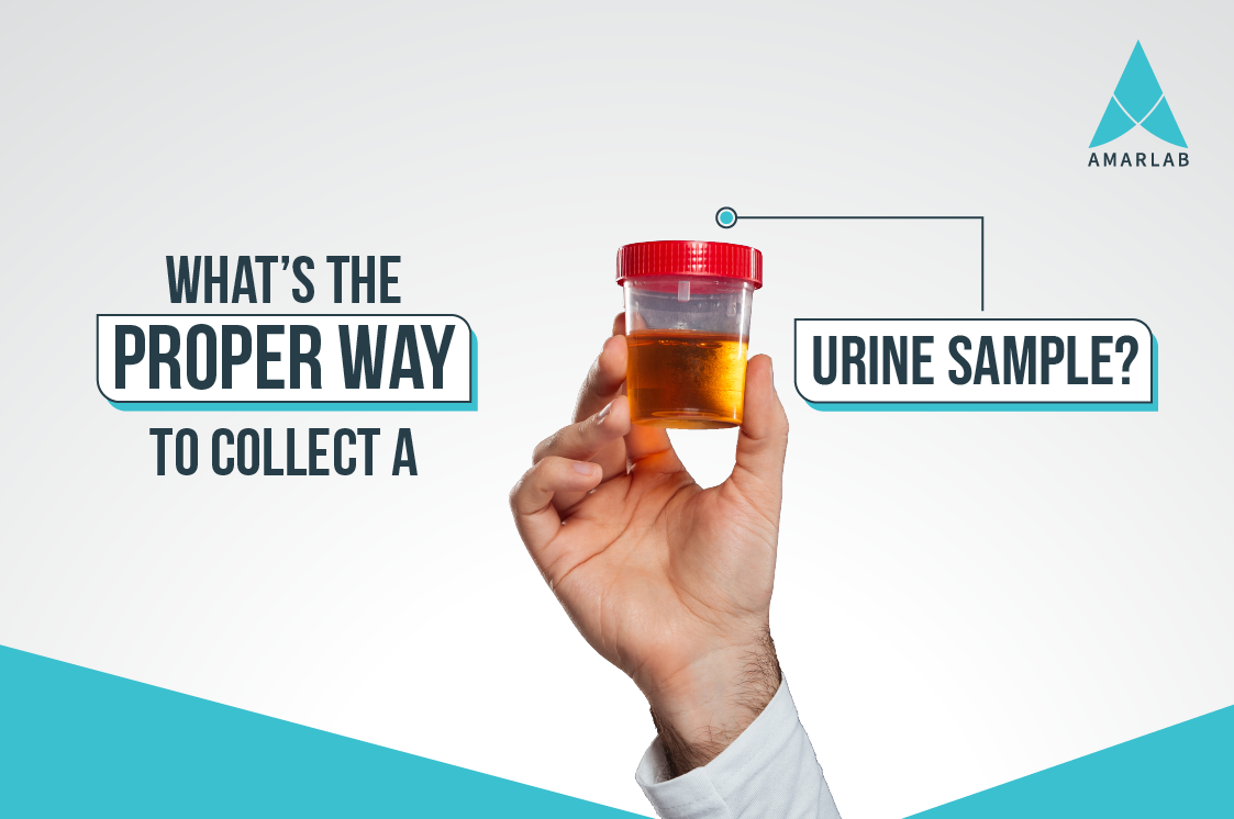 What’s the Proper Way to Collect A Urine Sample? Amarlab Blog